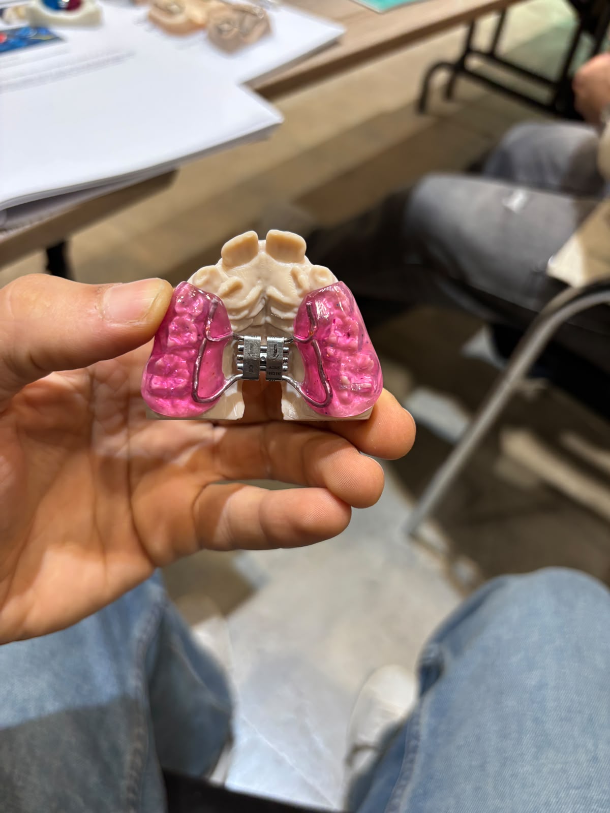 Pose d'implant dentaire